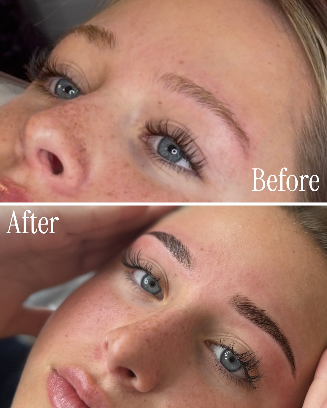 Brow transformation